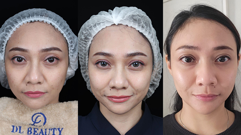 Treatment Juvenation 7D by DL Signature, Perawatan untuk Wajah Awet Muda Treatment Juvenation 7D by DL Signature, Perawatan untuk Wajah Awet Muda